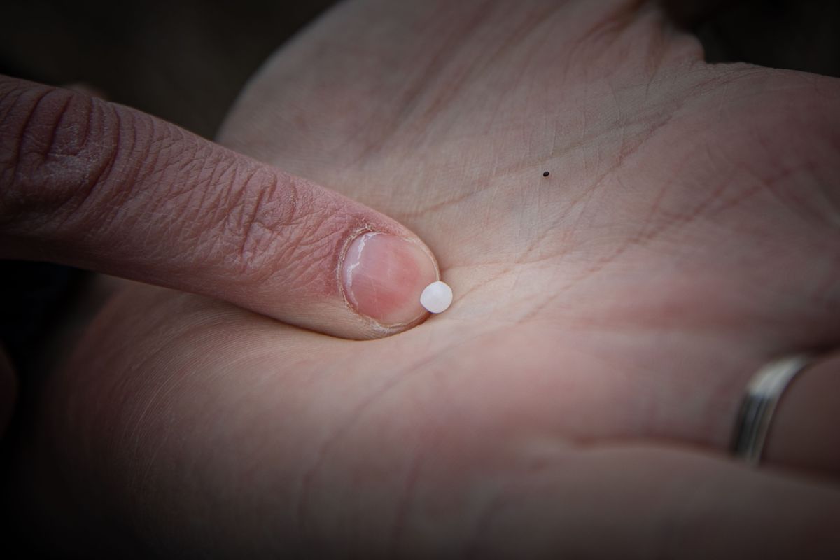 microplastics-used-in-food-packaging-detected-in-the-brain-two-hours-after-ingestion