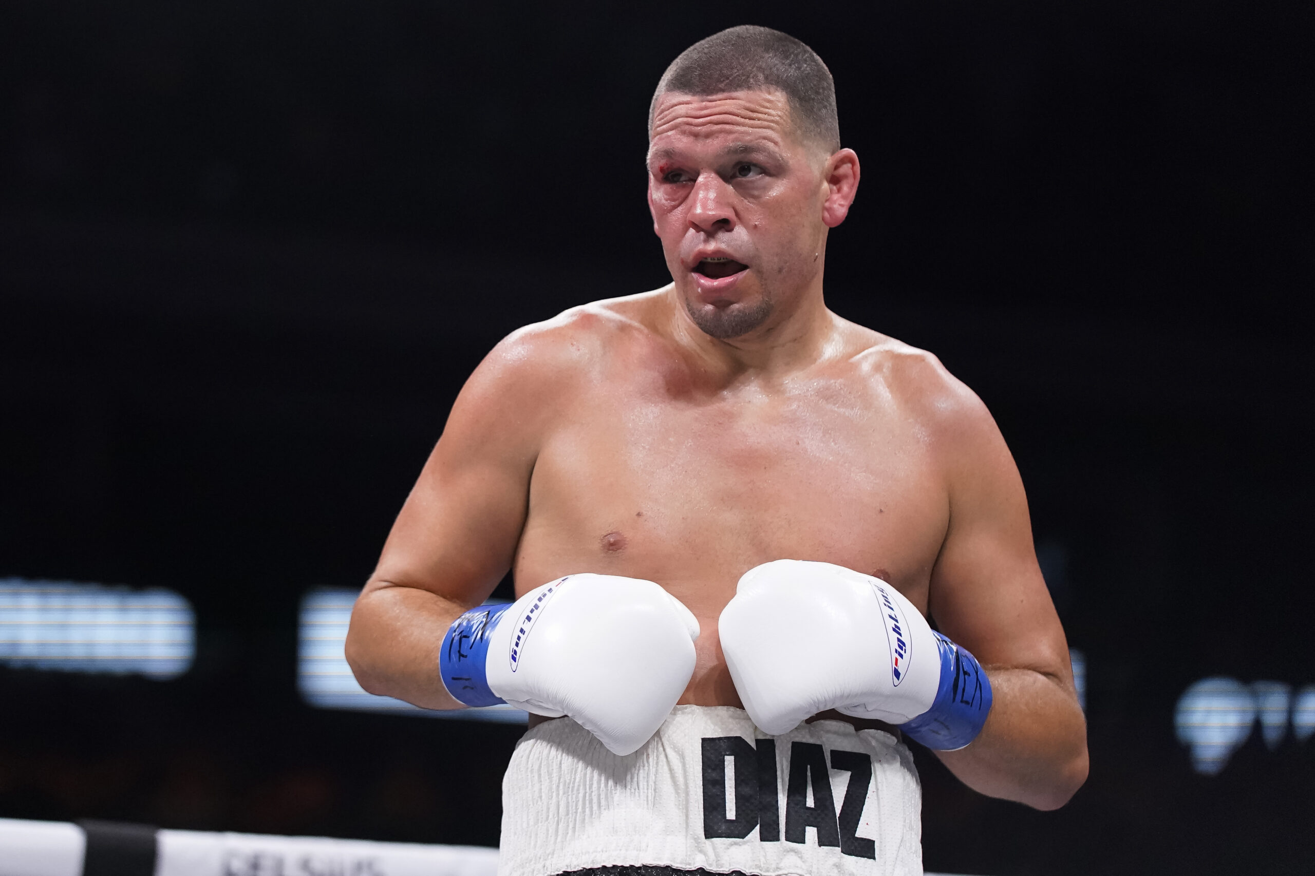 charges-against-nate-diaz-in-a-street-fight-that-occurred-in-new-orleans-are-dismissed