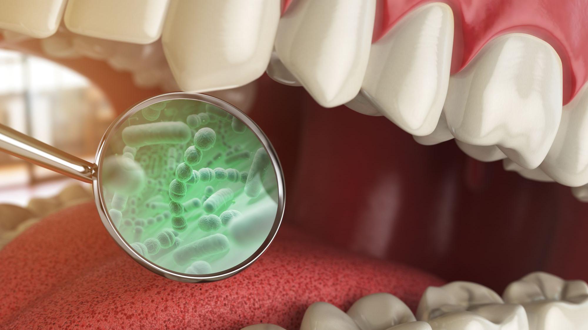 the-dangers-of-oral-bacteria:-4-diseases-you-should-know-about