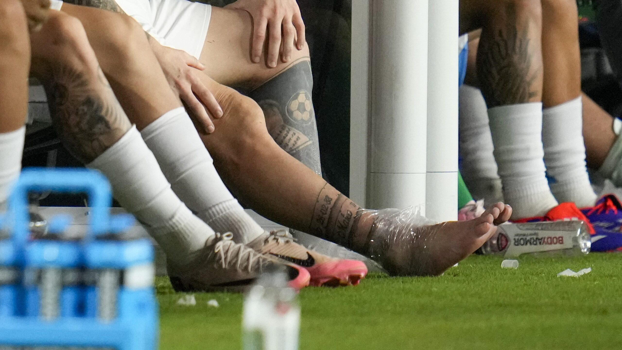 messi's-injury-in-the-middle-of-the-2024-copa-america-final-caused-a-sensation-due-to-the-size-of-his-ankle